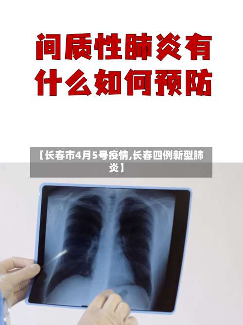 【长春市4月5号疫情,长春四例新型肺炎】