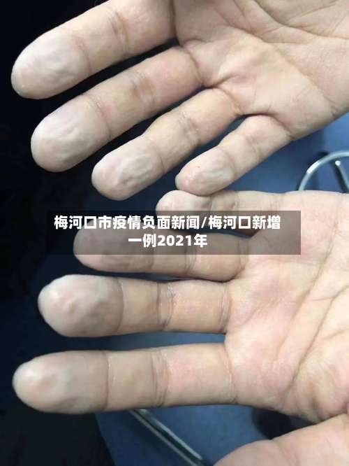 梅河口市疫情负面新闻/梅河口新增一例2021年