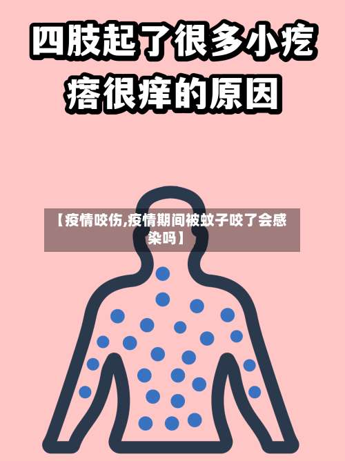 【疫情咬伤,疫情期间被蚊子咬了会感染吗】