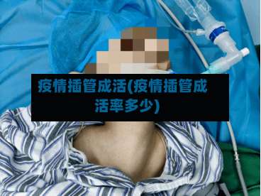 疫情插管成活(疫情插管成活率多少)-第1张图片
