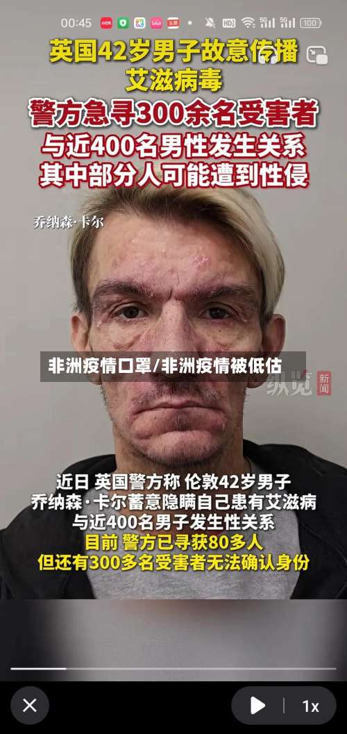 非洲疫情口罩/非洲疫情被低估