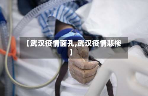 【武汉疫情面孔,武汉疫情悲惨】-第2张图片