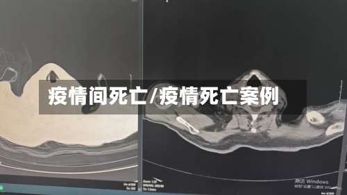疫情间死亡/疫情死亡案例