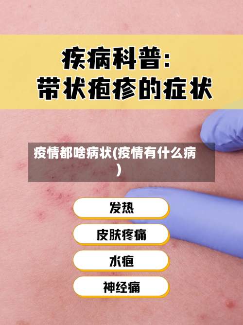 疫情都啥病状(疫情有什么病)-第2张图片