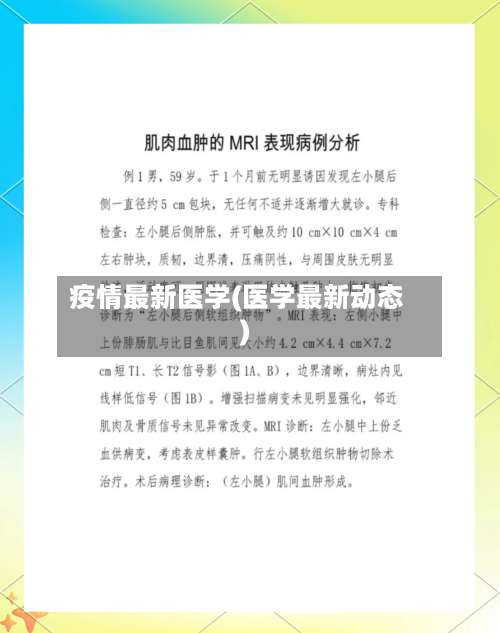 疫情最新医学(医学最新动态)-第3张图片
