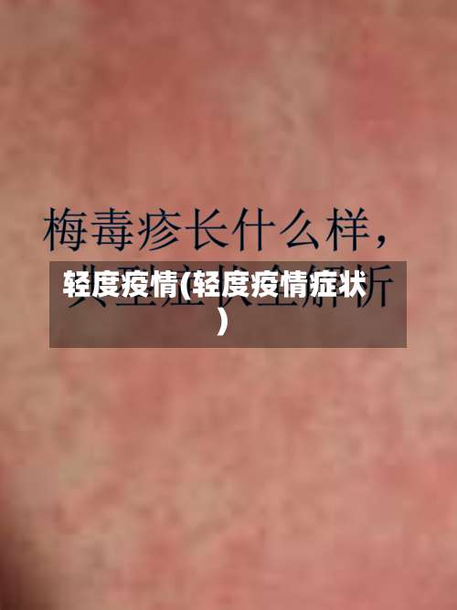 轻度疫情(轻度疫情症状)