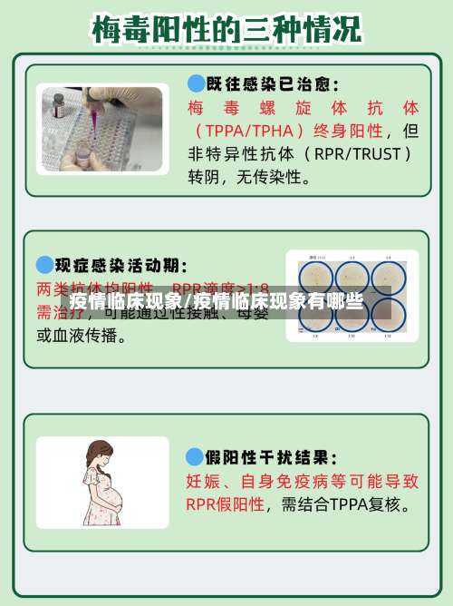 疫情临床现象/疫情临床现象有哪些-第2张图片