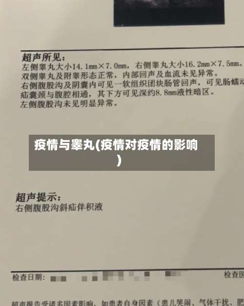 疫情与睾丸(疫情对疫情的影响)-第2张图片