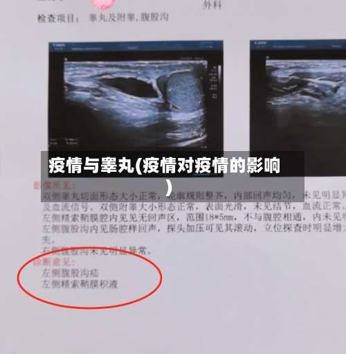 疫情与睾丸(疫情对疫情的影响)