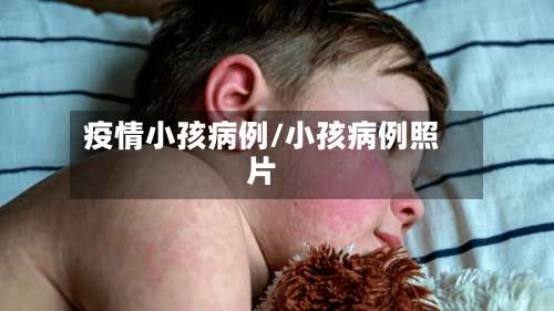疫情小孩病例/小孩病例照片