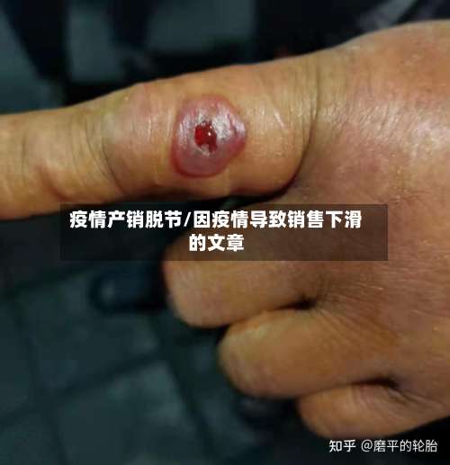 疫情产销脱节/因疫情导致销售下滑的文章