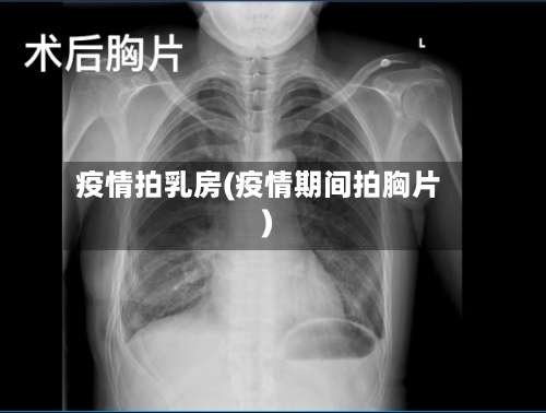 疫情拍乳房(疫情期间拍胸片)